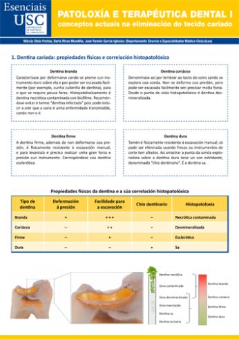 Cuberta para Patoloxía e terapéutica dental I: conceptos actuais na eliminación do tecido cariado